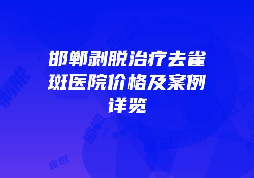 邯郸剥脱治疗去雀斑医院价格及案例详览
