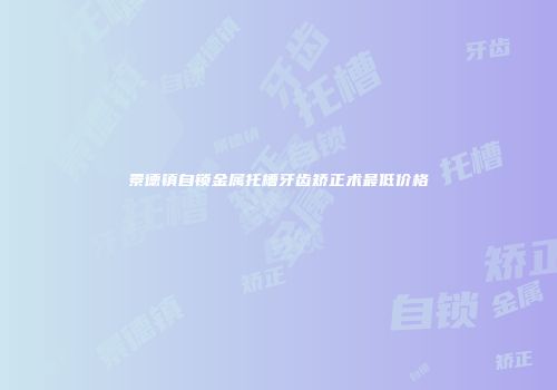 景德镇自锁金属托槽牙齿矫正术最低价格