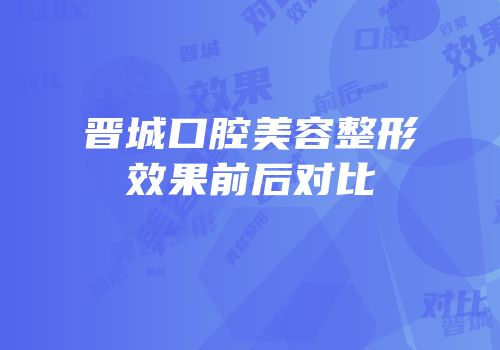 晋城口腔美容整形效果前后对比