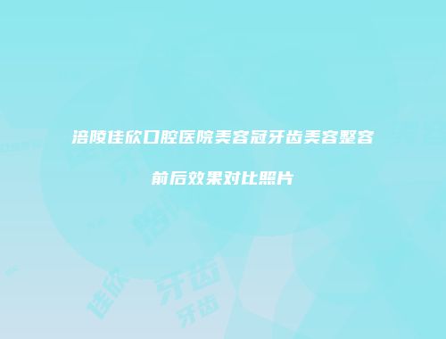 涪陵佳欣口腔医院美容冠牙齿美容整容前后效果对比照片