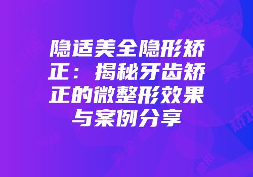 隐适美全隐形矫正：揭秘牙齿矫正的微整形效果与案例分享