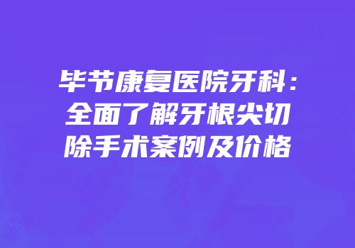 毕节康复医院牙科：全面了解牙根尖切除手术案例及价格