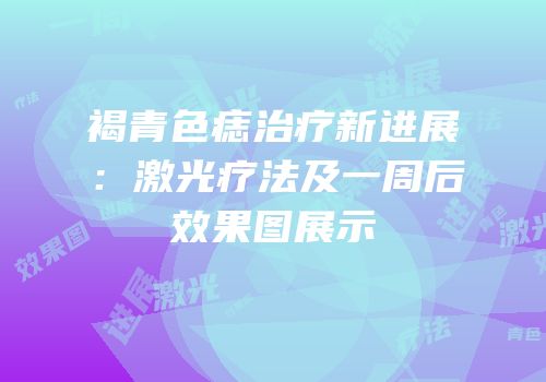 褐青色痣治疗新进展：激光疗法及一周后效果图展示
